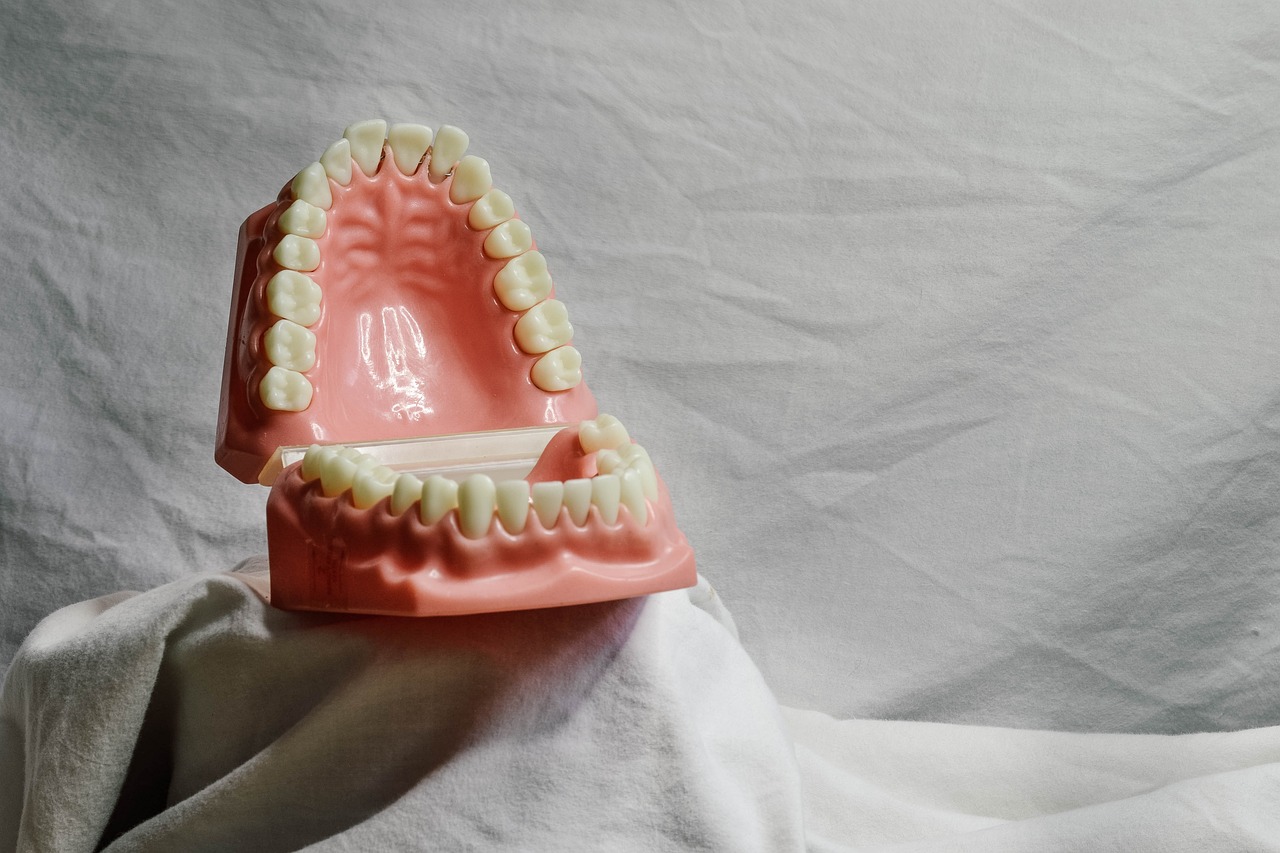 A dental model used to show patients how teeth and gums work